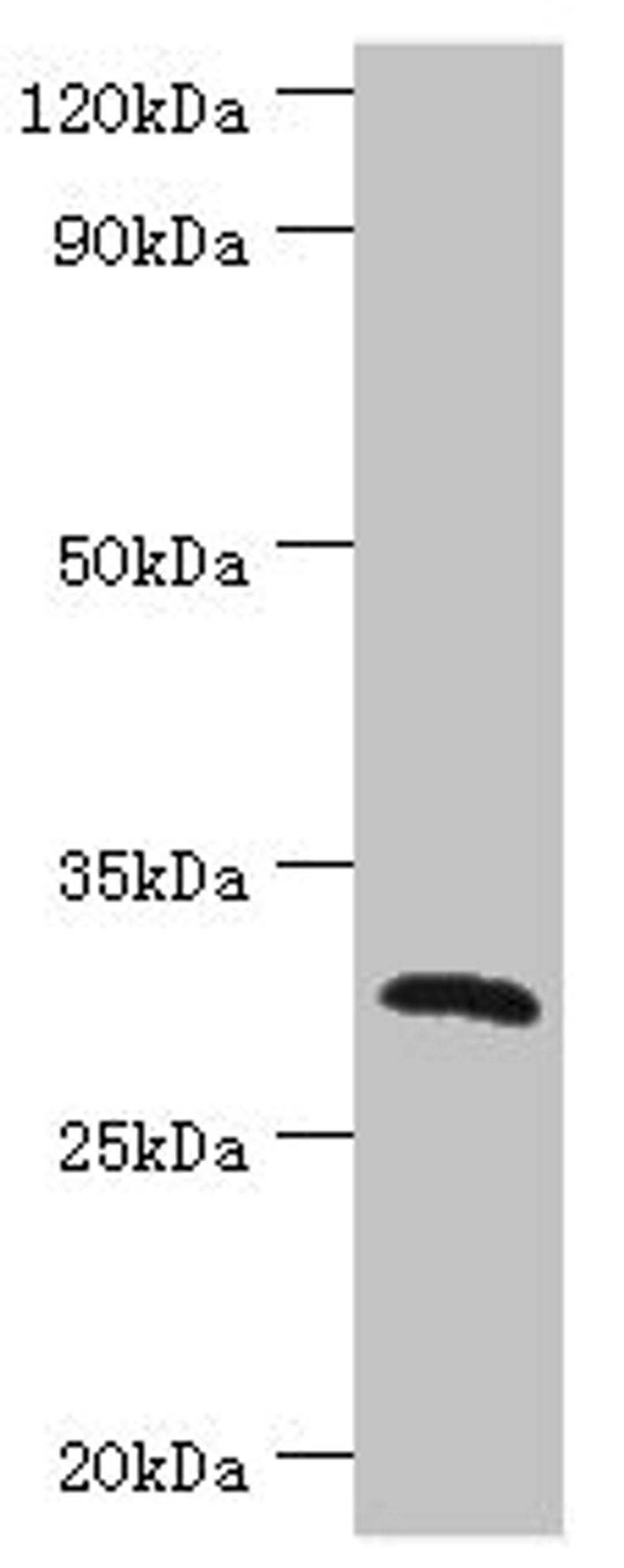 Western blot. All lanes: C-type lectin domain family 12 member A antibody at 2ug/ml + Mouse skeletal muscle tissue. Secondary. Goat polyclonal to rabbit IgG at 1/10000 dilution. Predicted band size: 31, 33, 9, 28, 25 kDa. Observed band size: 31 kDa.