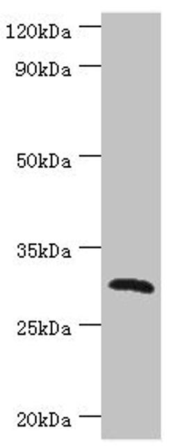 Western blot. All lanes: C-type lectin domain family 12 member A antibody at 2ug/ml + Mouse skeletal muscle tissue. Secondary. Goat polyclonal to rabbit IgG at 1/10000 dilution. Predicted band size: 31, 33, 9, 28, 25 kDa. Observed band size: 31 kDa.