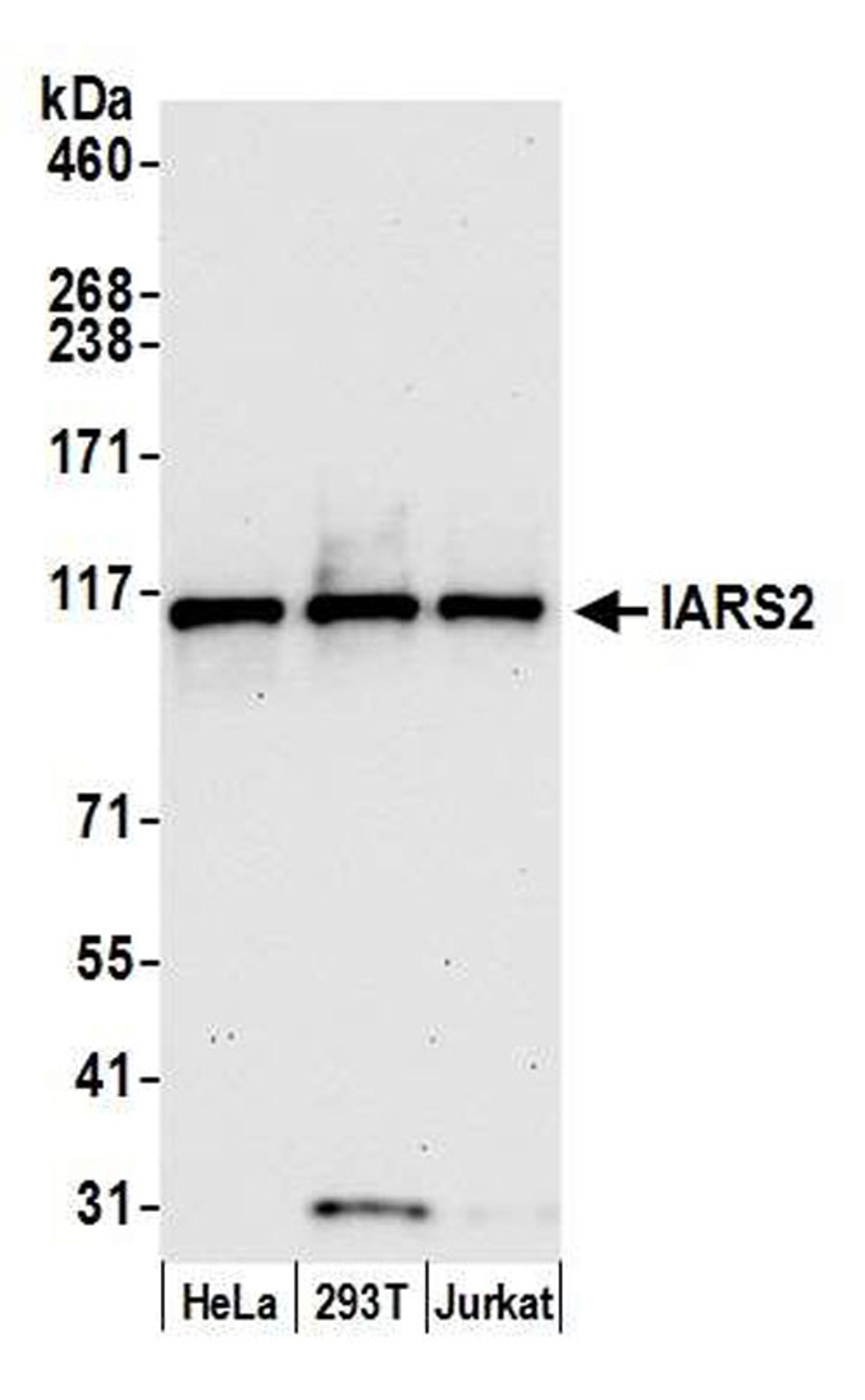 Detection of human IARS2 by WB.