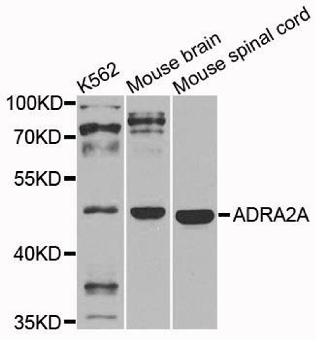 Western blot analysis of extracts of various cells using ADRA2A antibody