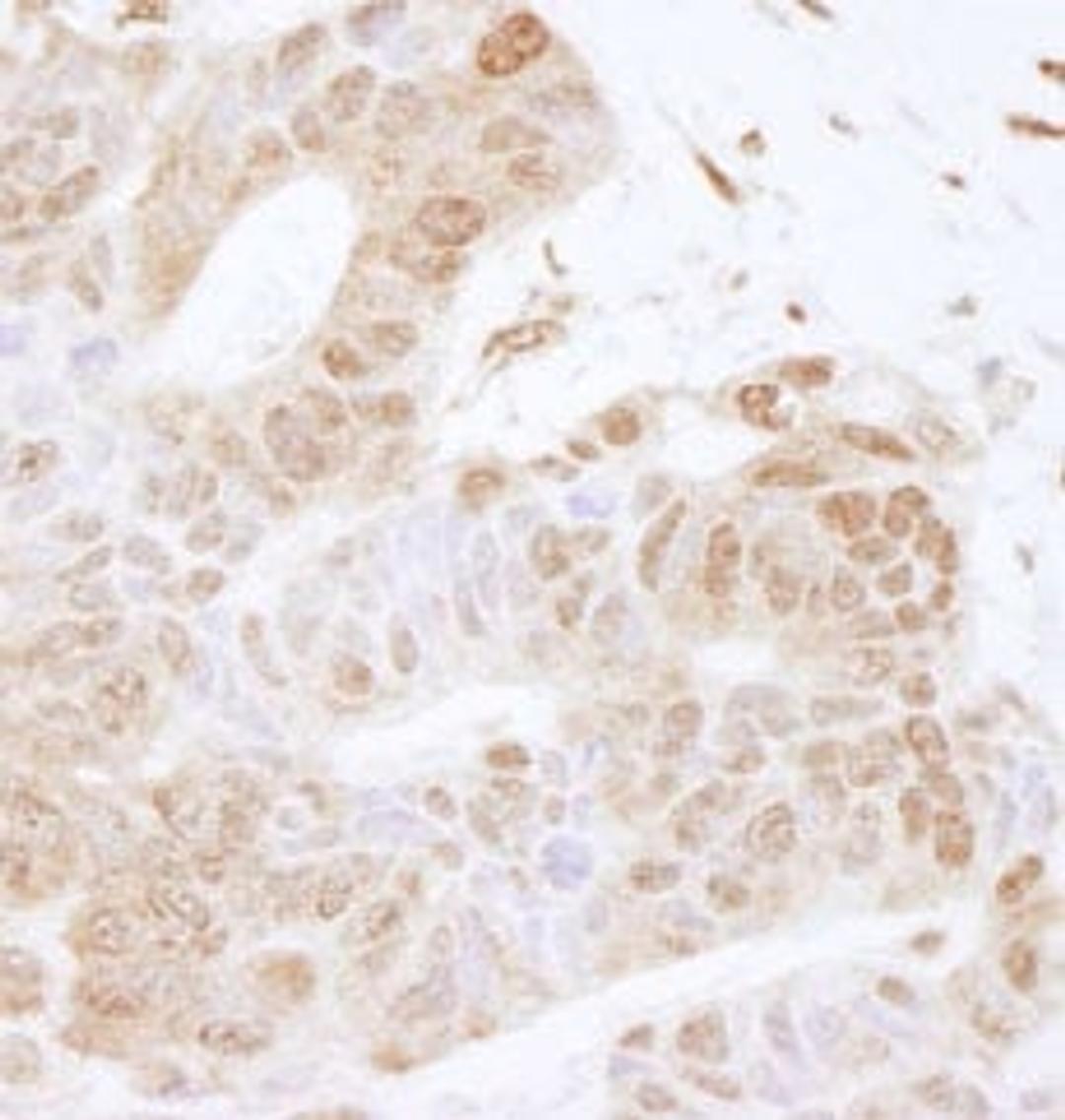 Detection of human FOXK2 by immunohistochemistry.