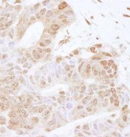 Detection of human FOXK2 by immunohistochemistry.