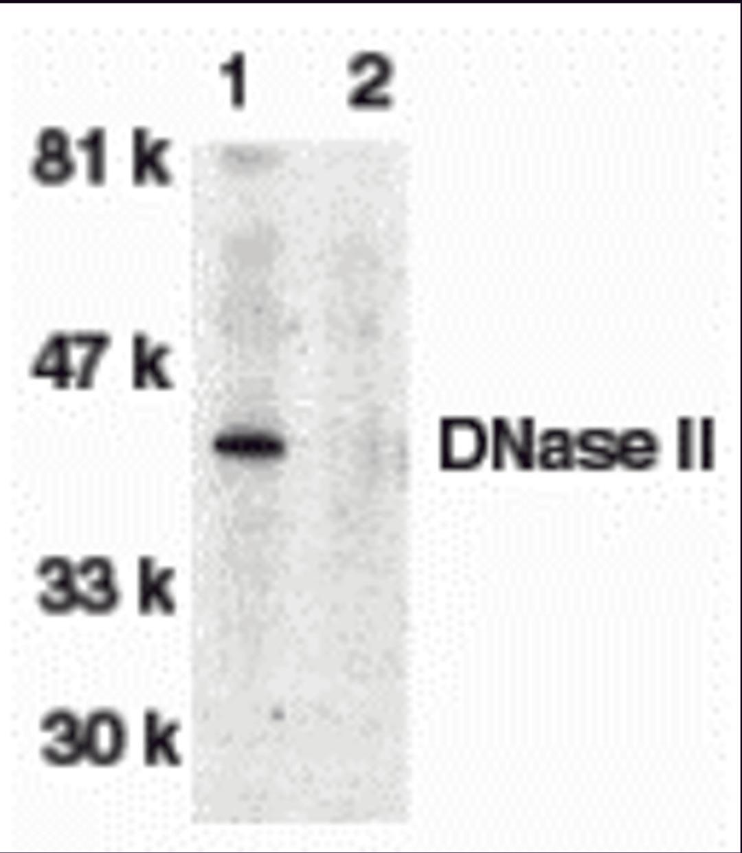 Western blot analysis of DNase II in human spleen tissue lysate in the absence (lane 1) or presence (lane 2) of blocking peptide with DNase antibody II at 1:500 dilution.