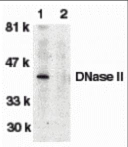 Western blot analysis of DNase II in human spleen tissue lysate in the absence (lane 1) or presence (lane 2) of blocking peptide with DNase antibody II at 1:500 dilution.