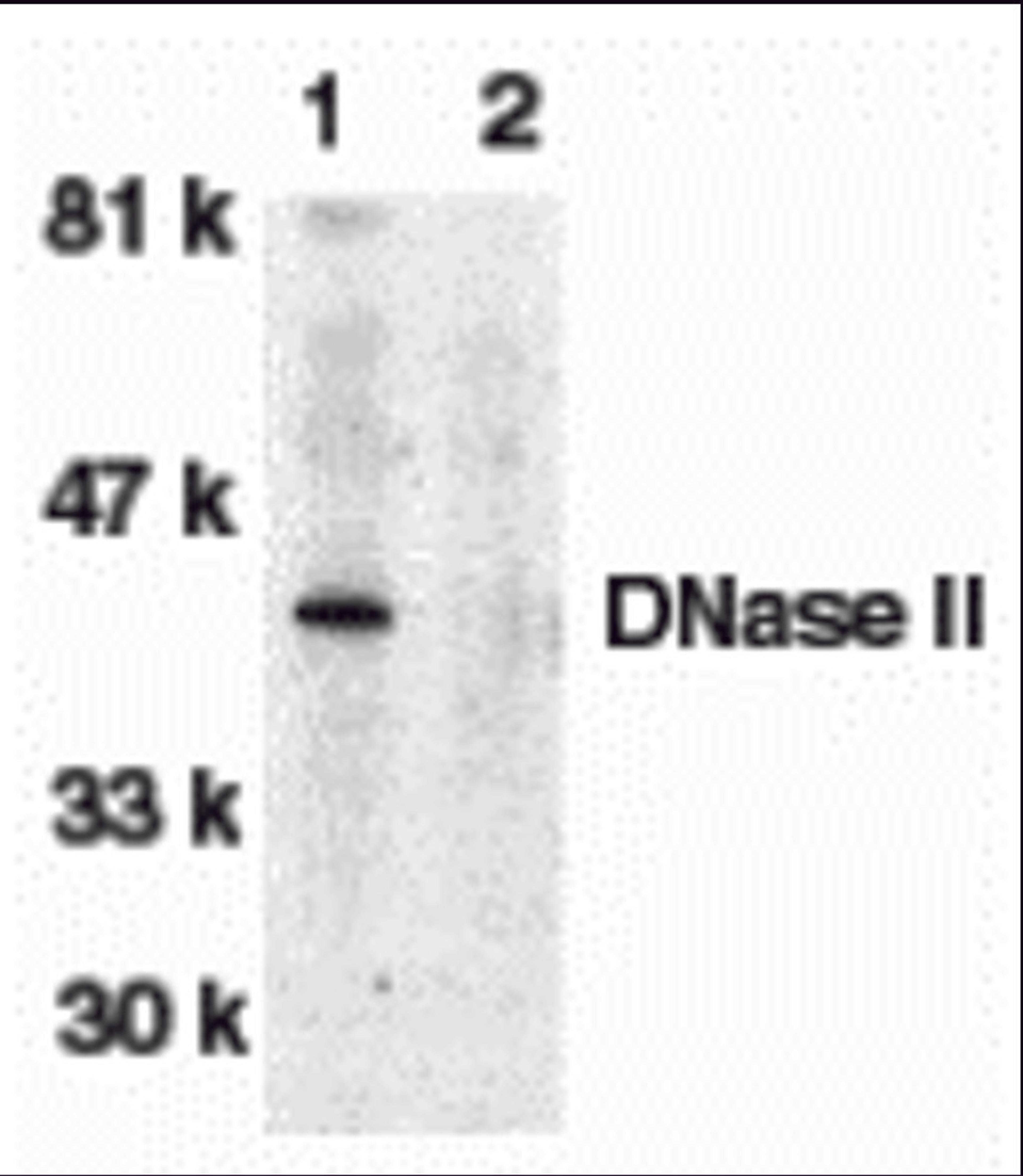 Western blot analysis of DNase II in human spleen tissue lysate in the absence (lane 1) or presence (lane 2) of blocking peptide with DNase antibody II at 1:500 dilution.