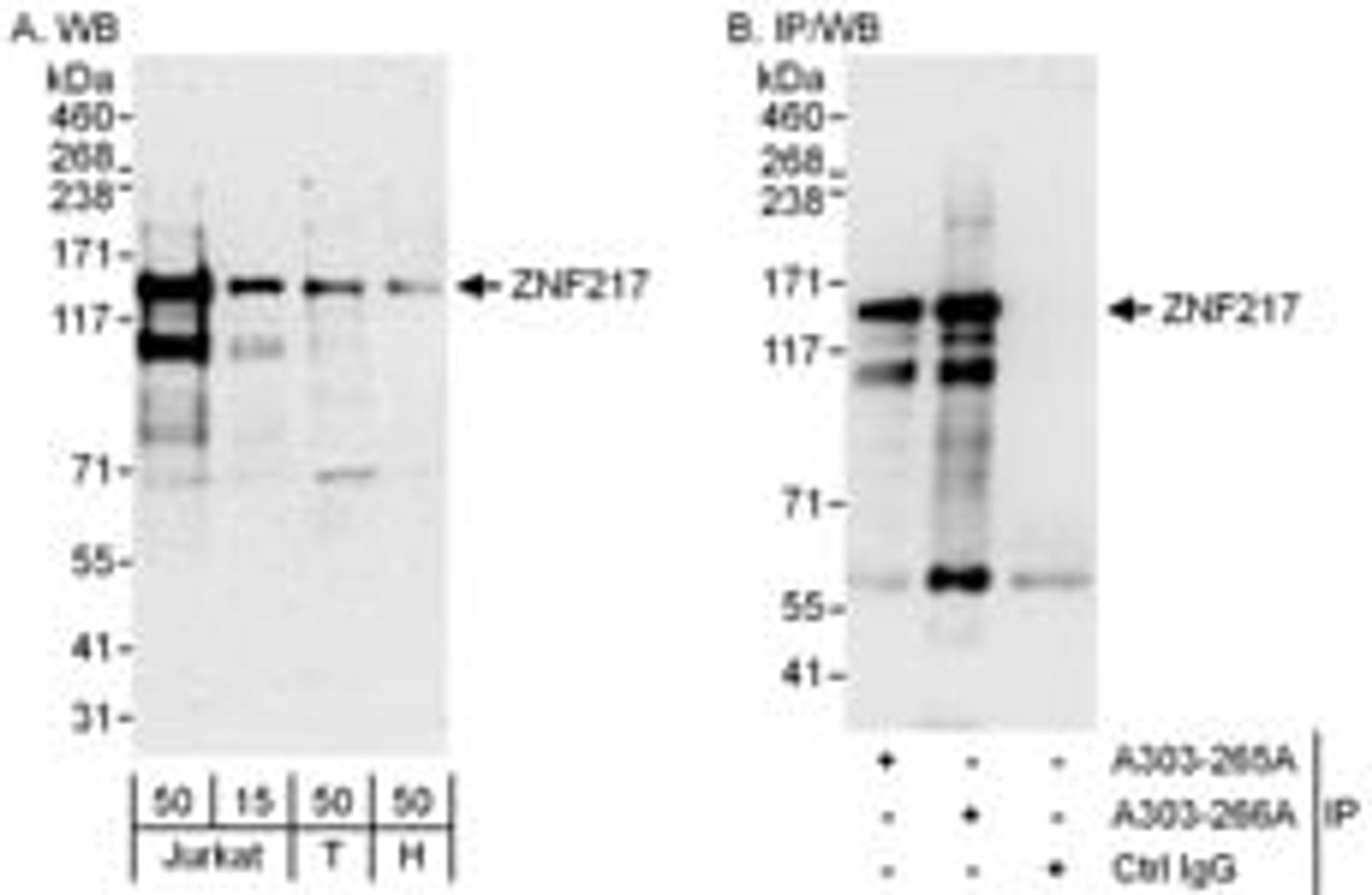 Detection of human ZNF217 by western blot and immunoprecipitation.