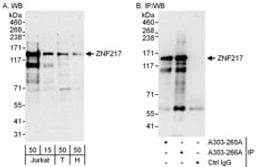 Detection of human ZNF217 by western blot and immunoprecipitation.