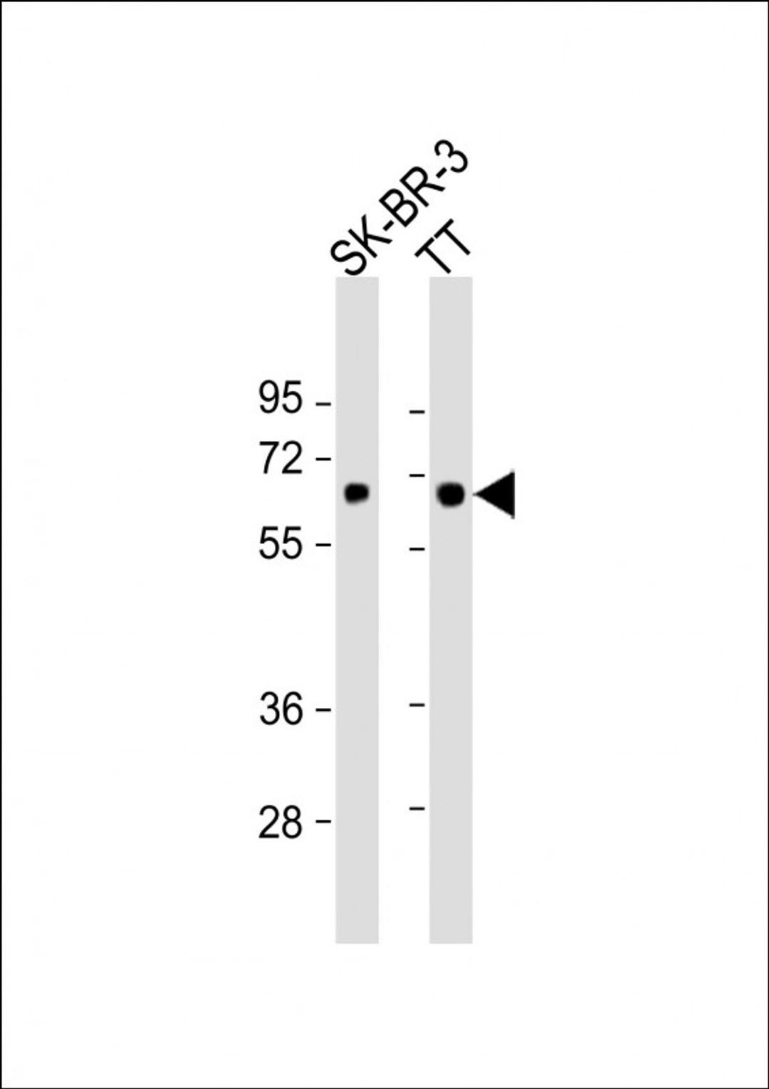 Western Blot at 1:1000 dilution Lane 1: SK-BR-3 whole cell lysate Lane 2: TT whole cell lysate Lysates/proteins at 20 ug per lane.