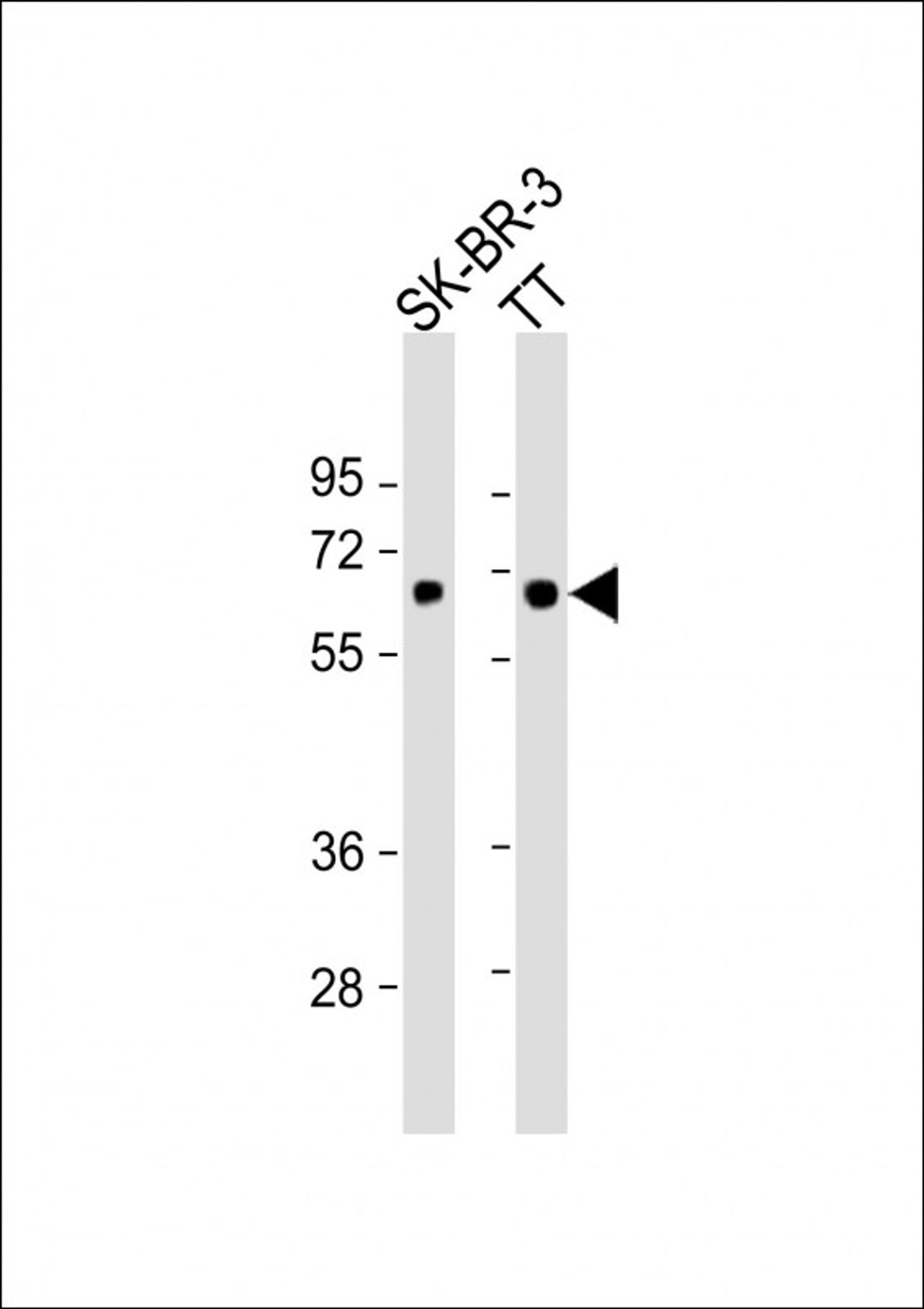 Western Blot at 1:1000 dilution Lane 1: SK-BR-3 whole cell lysate Lane 2: TT whole cell lysate Lysates/proteins at 20 ug per lane.