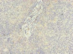 Immunohistochemistry of paraffin-embedded human tonsil tissue using CSB-PA773053LA01HU at dilution of 1:100
