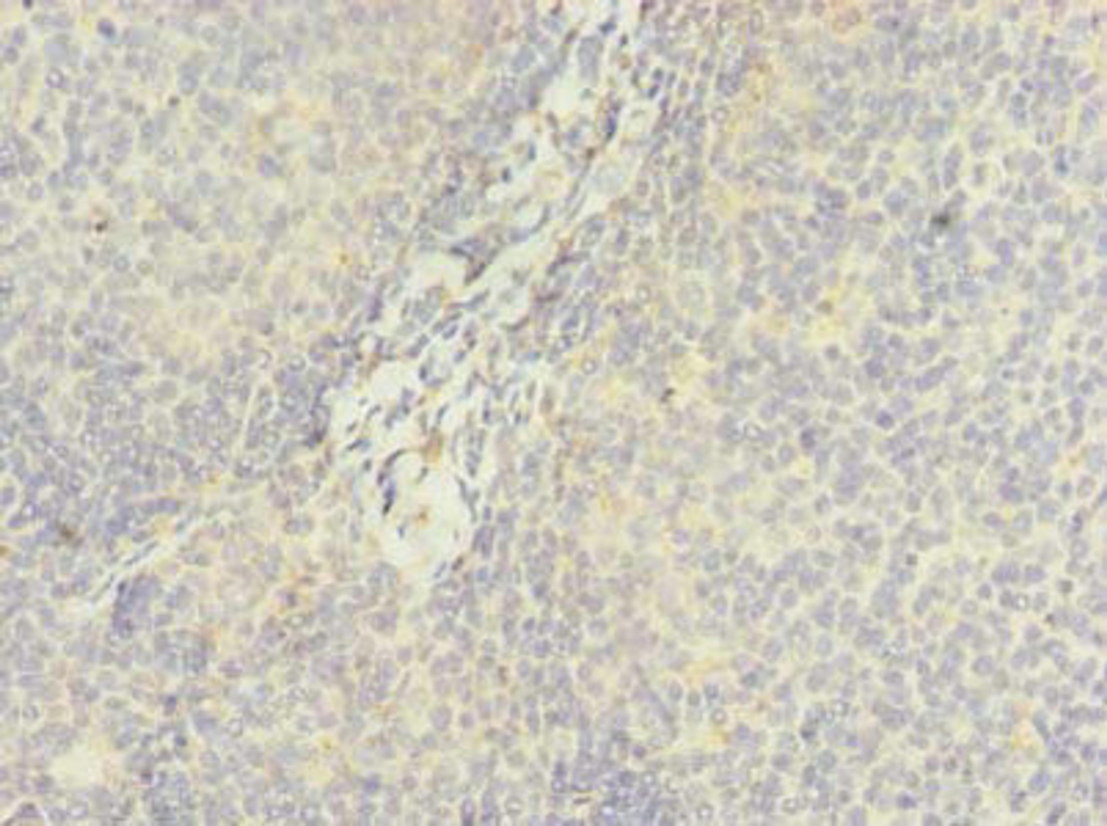 Immunohistochemistry of paraffin-embedded human tonsil tissue using CSB-PA773053LA01HU at dilution of 1:100