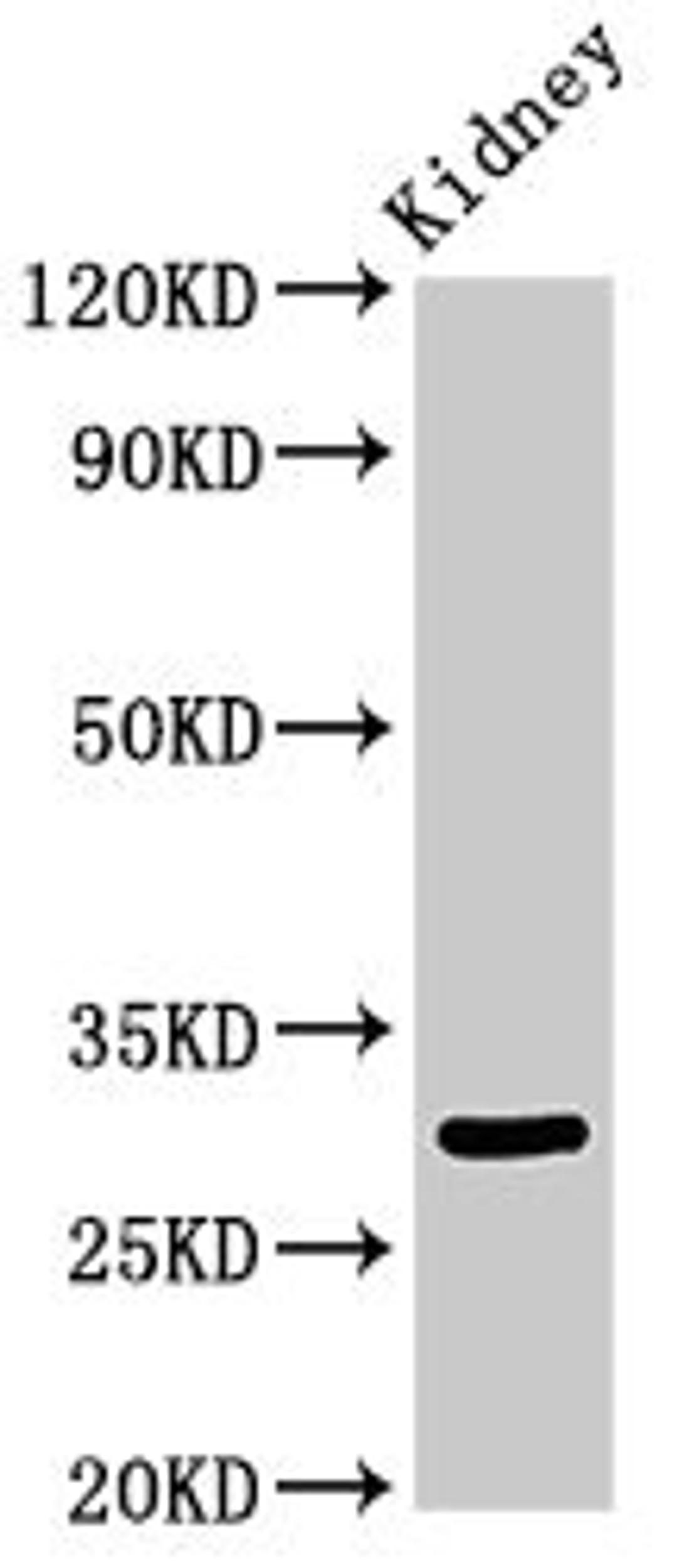 Western Blot. Positive WB detected in: Rat kidney tissue. All lanes: IGFBP7 antibody at 3.4ug/ml. Secondary. Goat polyclonal to rabbit IgG at 1/50000 dilution. Predicted band size: 30, 29 kDa. Observed band size: 30 kDa. 