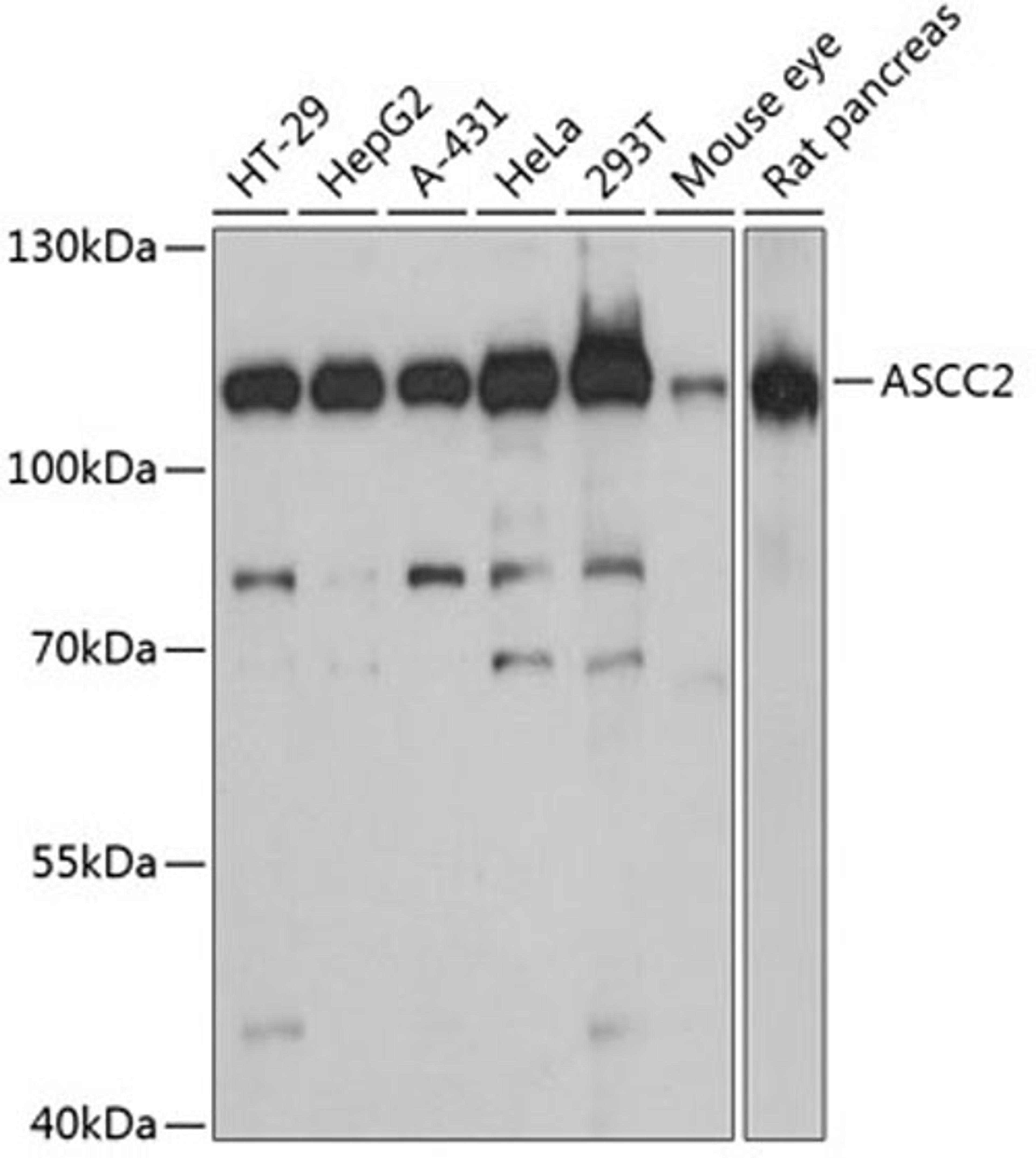 Western blot - ASCC2 antibody (A13789)