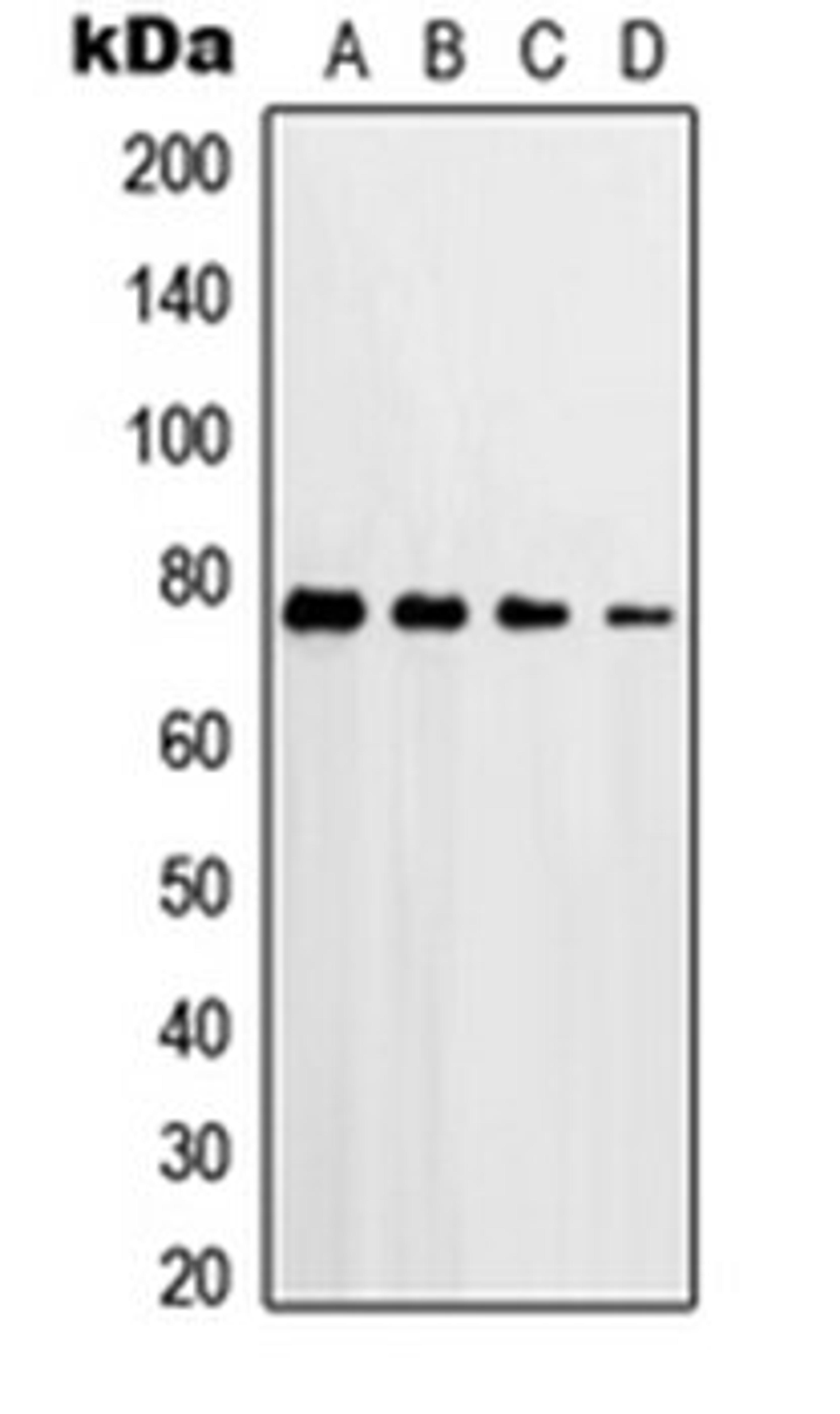 Western blot analysis of HeLa H2O2-treated (Lane 1), A549 H2O2-treated (Lane 2), Raw264.7 H2O2-treated (Lane 3), PC12 H2O2-treated (Lane 4) whole cell lysates using PRKCD antibody