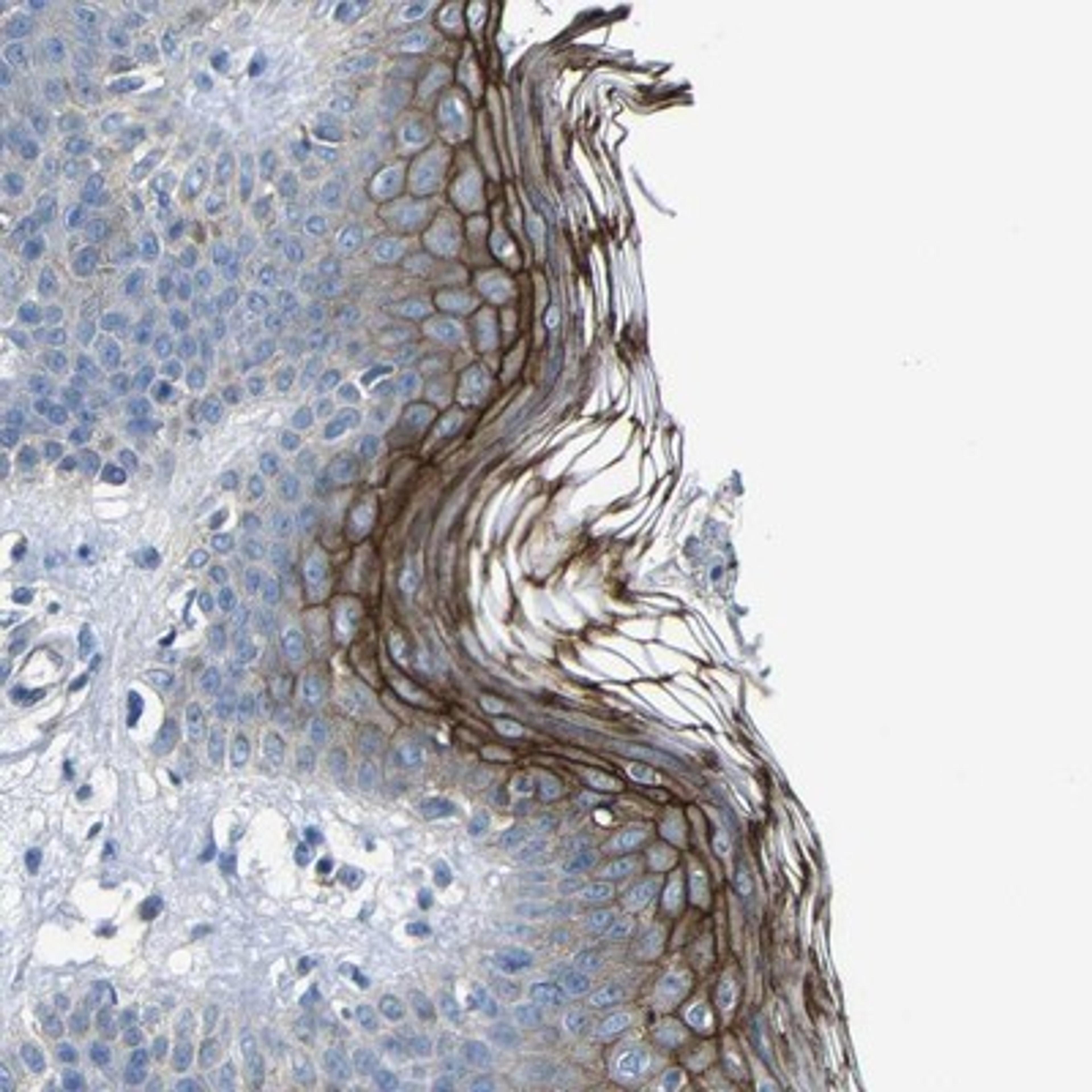 Immunohistochemistry-Paraffin: Desmocollin-1 Antibody [NBP1-88099] - Staining of human skin shows strong membranous positivity in epidermal cells.