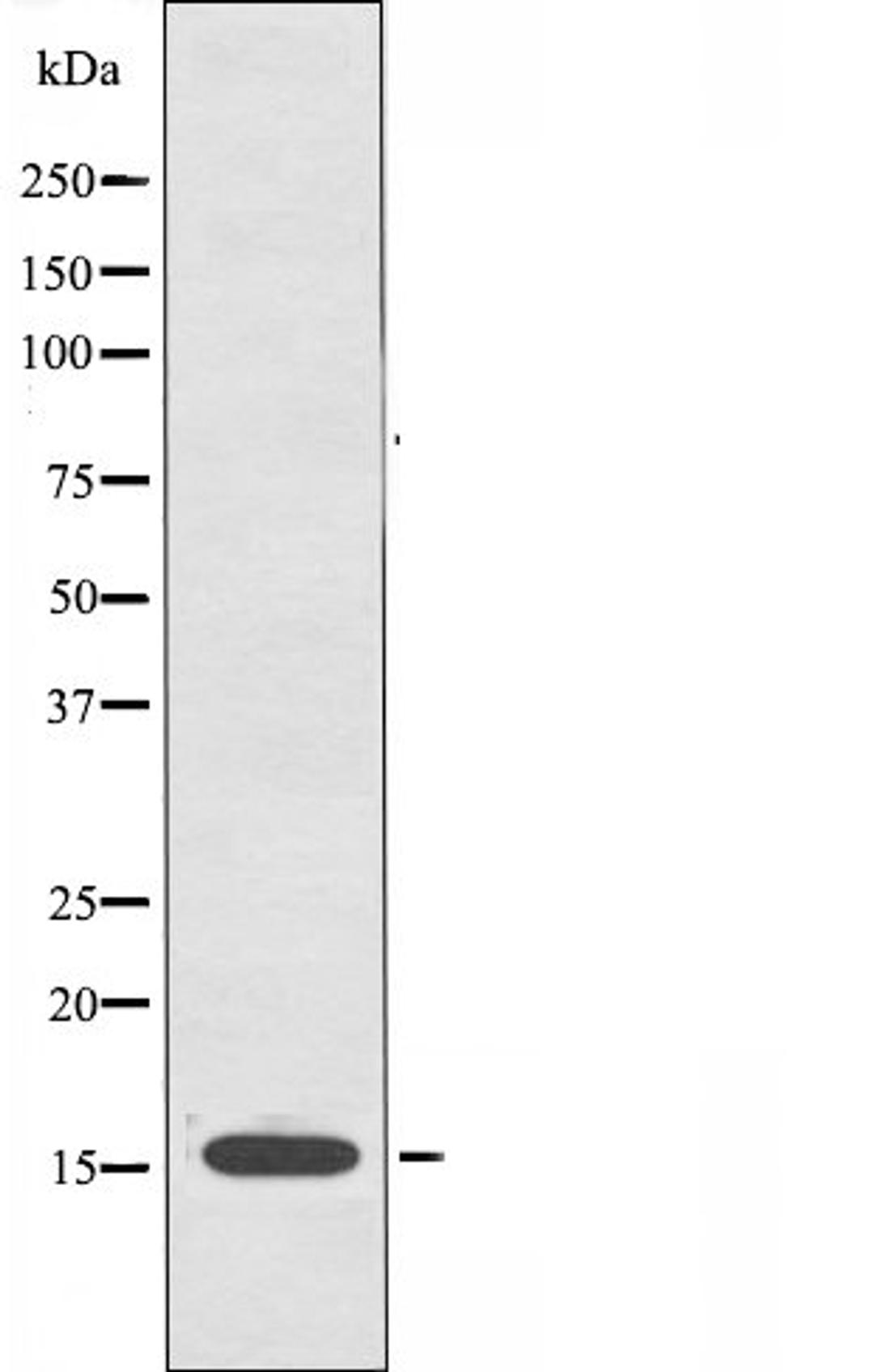 Western blot analysis of A549 cells using CYB5 antibody