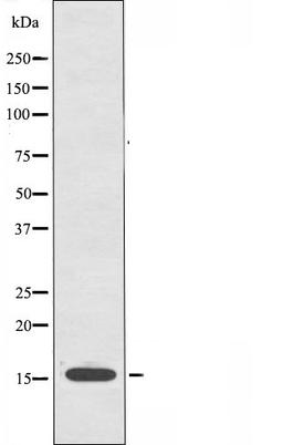 Western blot analysis of A549 cells using CYB5 antibody