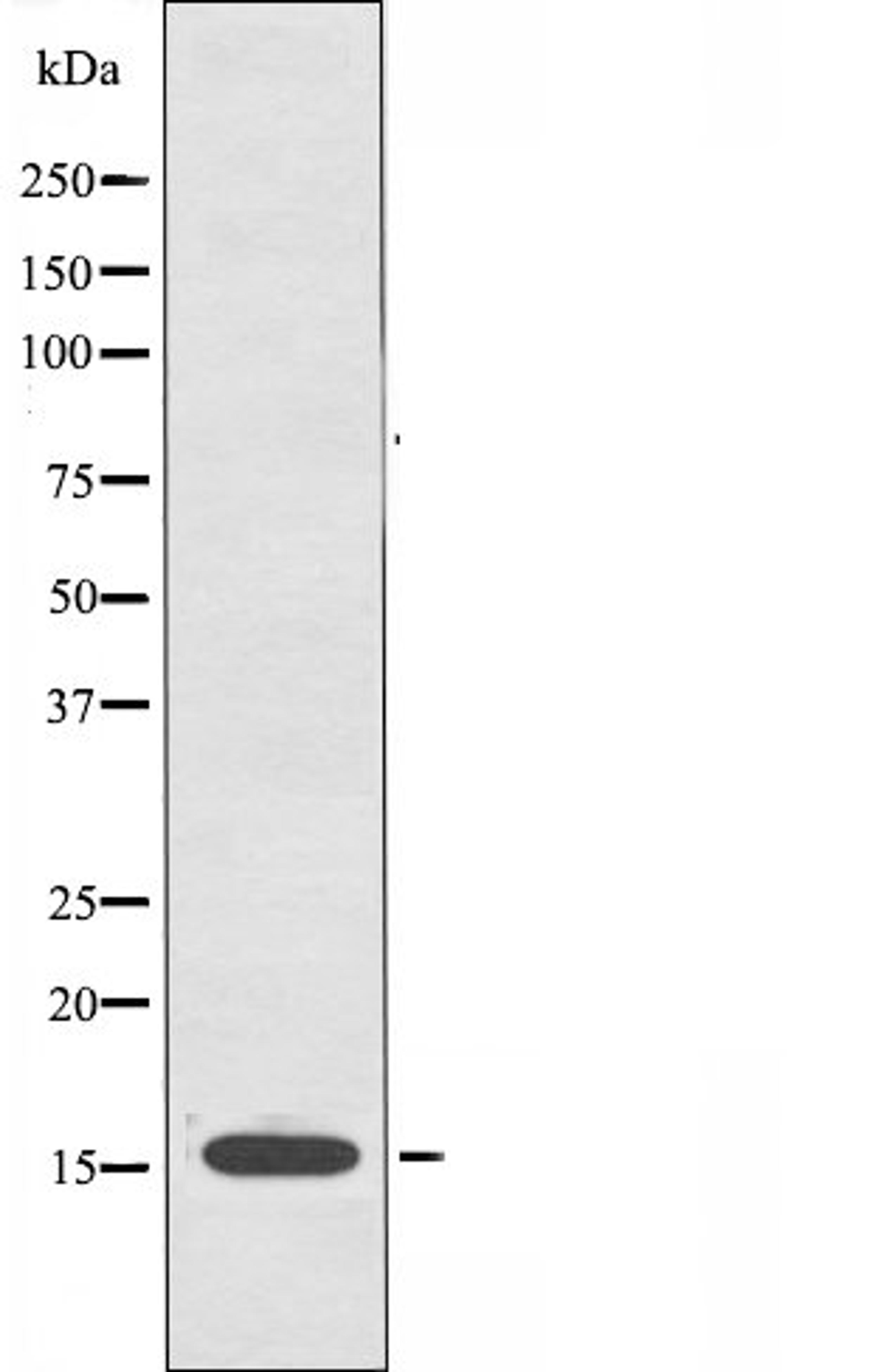 Western blot analysis of A549 cells using CYB5 antibody