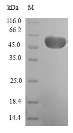 (Tris-Glycine gel) Discontinuous SDS-PAGE (reduced) with 5% enrichment gel and 15% separation gel.