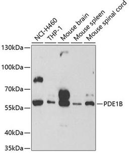 Western blot - PDE1B antibody (A2102)