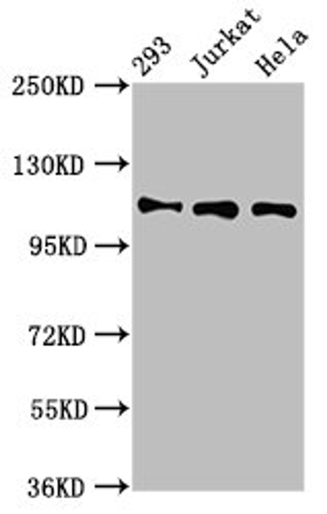Western Blot. Positive WB detected in: 293 whole cell lysate, Jurkat whole cell lysate, Hela whole cell lysate. All lanes: RAB3GAP1 antibody at 7µg/ml. Secondary. Goat polyclonal to rabbit IgG at 1/50000 dilution. Predicted band size: 111, 112, 106 kDa. Observed band size: 111 kDa