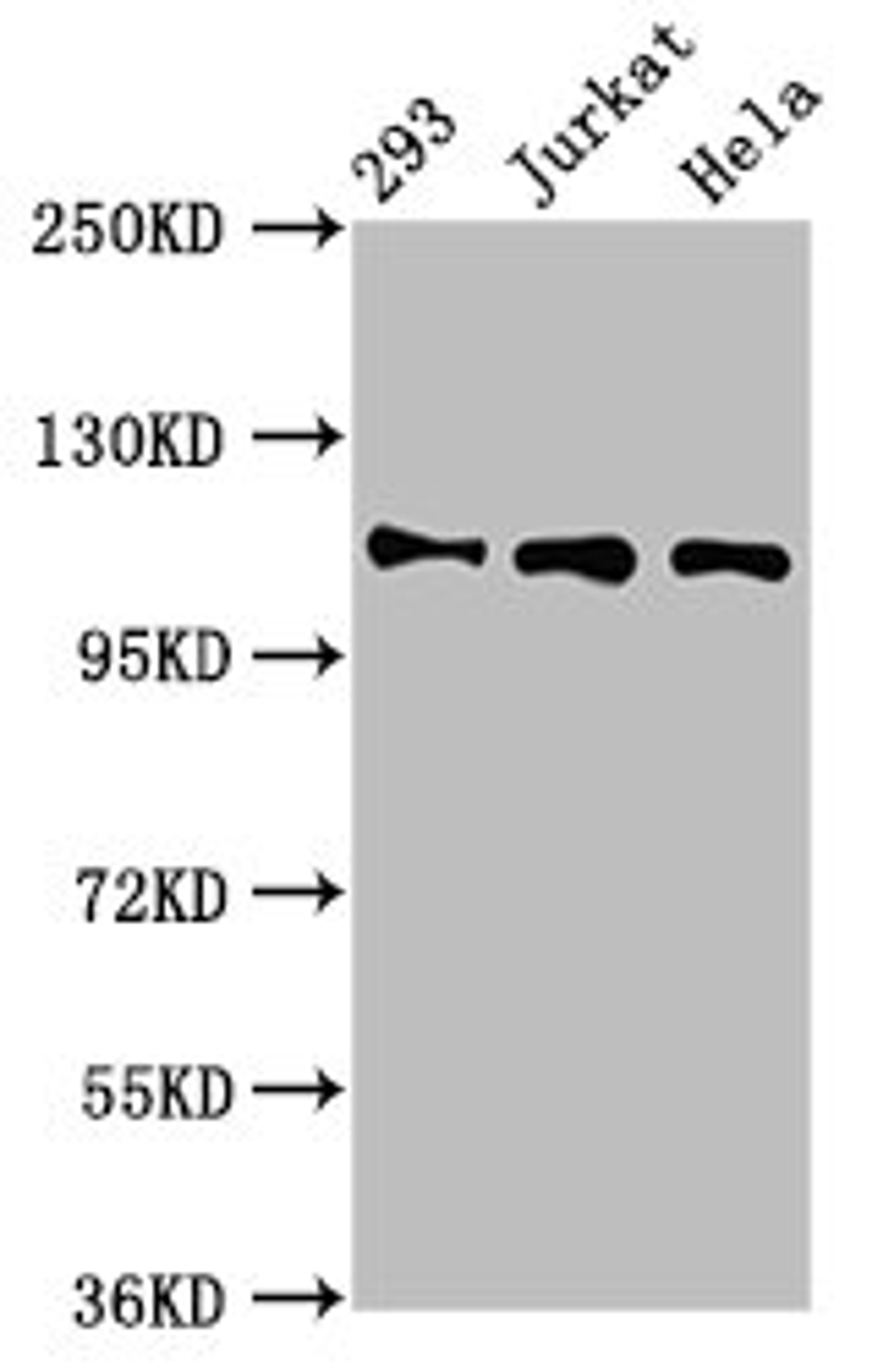 Western Blot. Positive WB detected in: 293 whole cell lysate, Jurkat whole cell lysate, Hela whole cell lysate. All lanes: RAB3GAP1 antibody at 7µg/ml. Secondary. Goat polyclonal to rabbit IgG at 1/50000 dilution. Predicted band size: 111, 112, 106 kDa. Observed band size: 111 kDa
