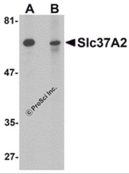 Western blot analysis of Slc37A2 in mouse spleen tissue lysate with Slc37A2 antibody at 1 μg/mL in the (A) absence and (B) presence of blocking peptide.