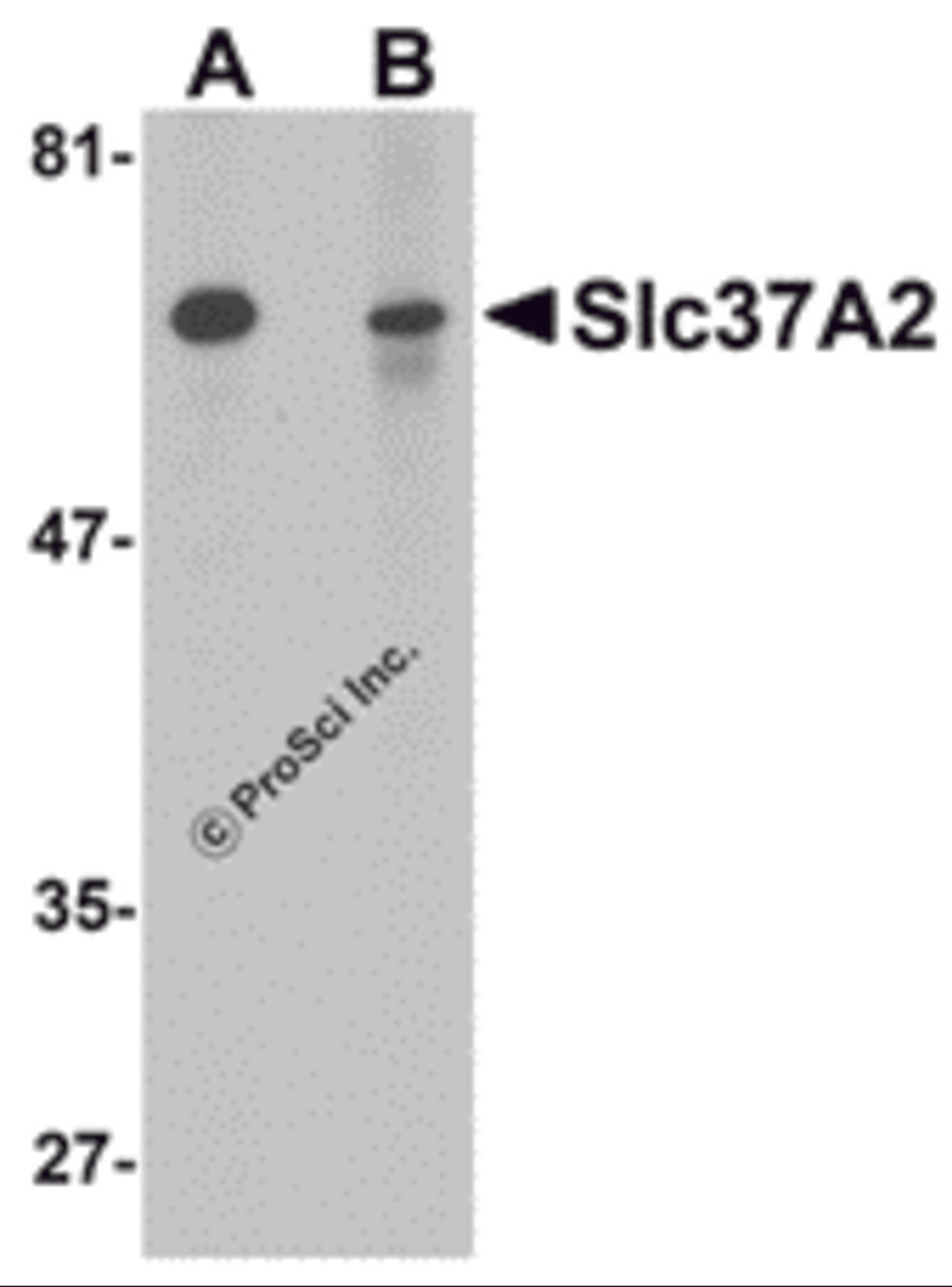 Western blot analysis of Slc37A2 in mouse spleen tissue lysate with Slc37A2 antibody at 1 μg/mL in the (A) absence and (B) presence of blocking peptide.