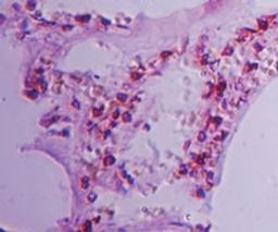 Immunohistochemistry-Paraffin: CLEC1A Antibody [NBP2-27096] - analysis using CLEC1 antibody. Formalin-fixed, paraffin-embedded human lung tissue probed with CLEC1 antibody at 5 ug/ml.