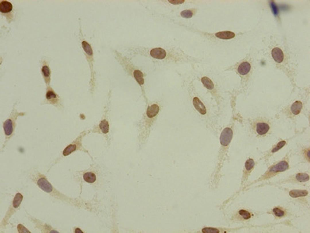 Immunocytochemistry analysis of Hela cells using CSB-PA010429OA08acHU at dilution of 1:100