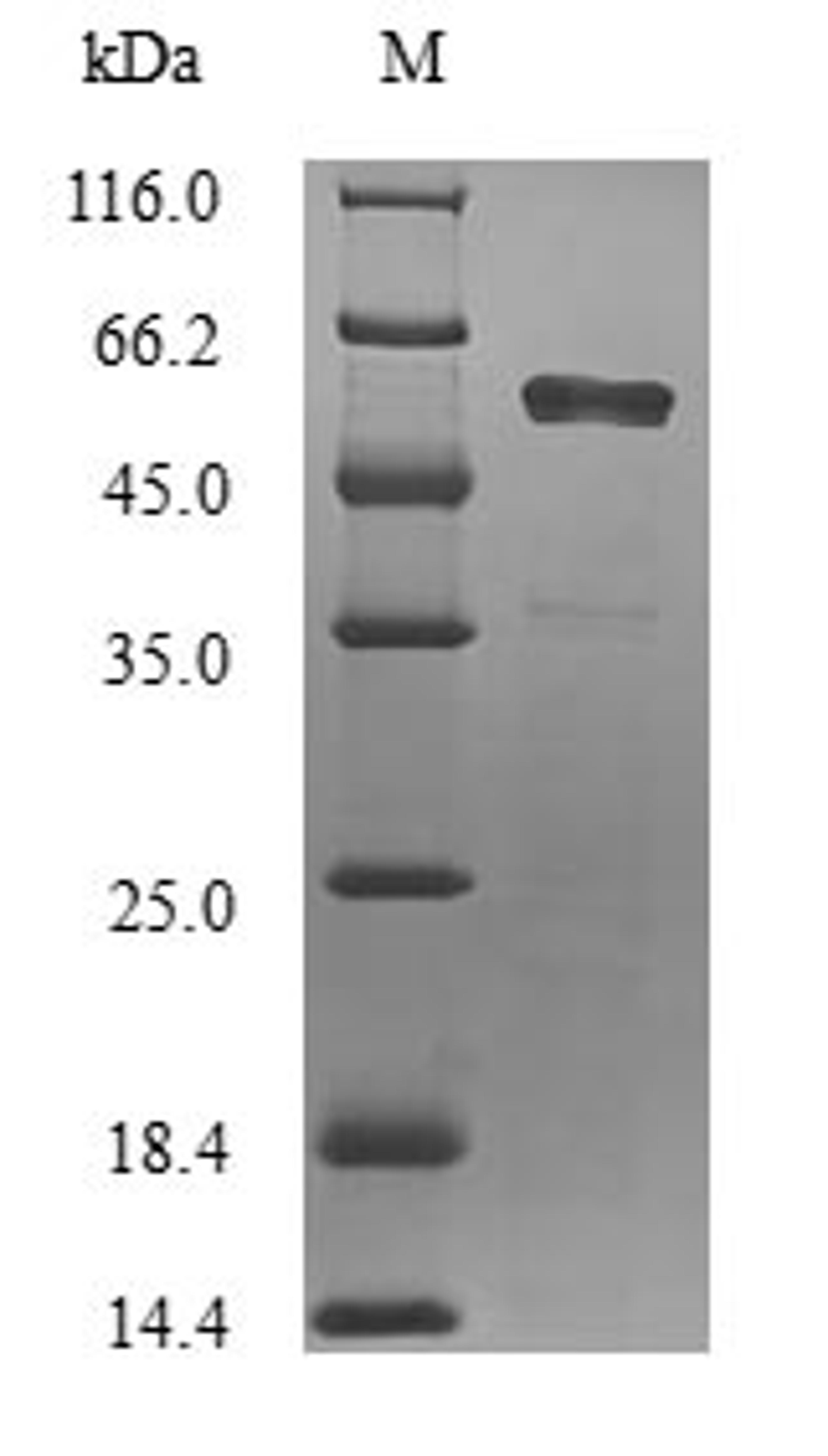 (Tris-Glycine gel) Discontinuous SDS-PAGE (reduced) with 5% enrichment gel and 15% separation gel.