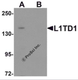 Western blot analysis of L1TD1 in Jurkat cell lysate with L1TD1 antibody at 1 &#956;g/mL in (A) the absence and (B) the presence of blocking peptide.