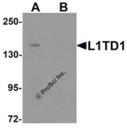 Western blot analysis of L1TD1 in Jurkat cell lysate with L1TD1 antibody at 1 μg/mL in (A) the absence and (B) the presence of blocking peptide.