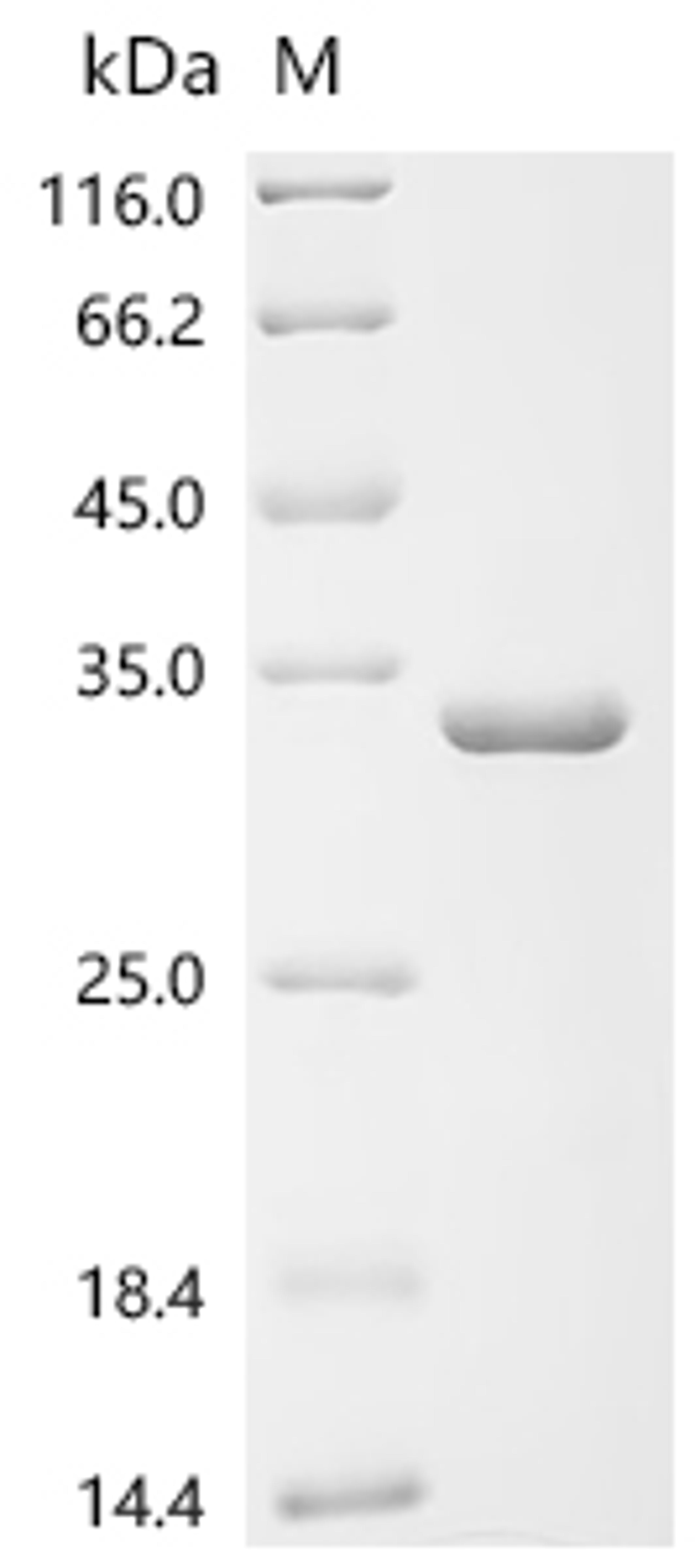 (Tris-Glycine gel) Discontinuous SDS-PAGE (reduced) with 5% enrichment gel and 15% separation gel.