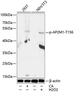 Western blot - Phospho-AP2M1-T156 antibody (AP0823)