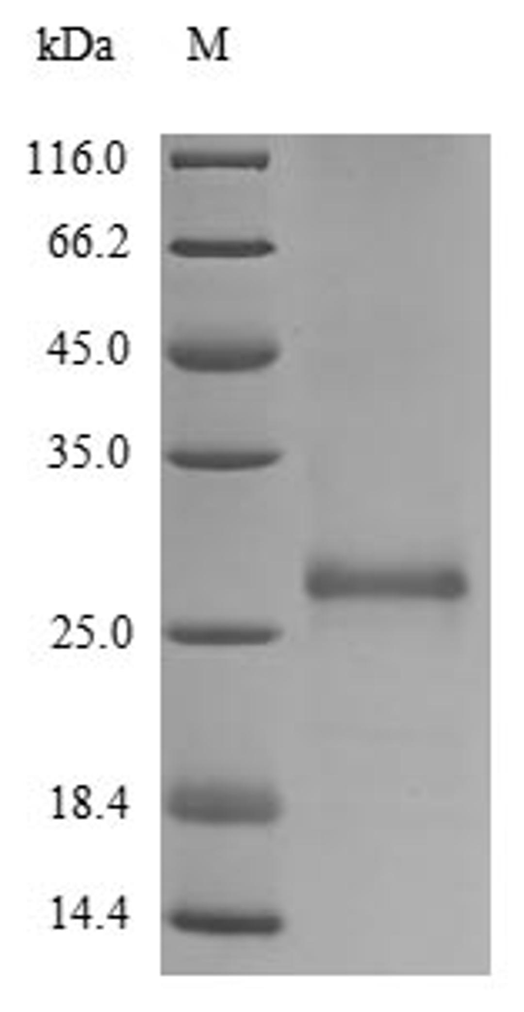 (Tris-Glycine gel) Discontinuous SDS-PAGE (reduced) with 5% enrichment gel and 15% separation gel.