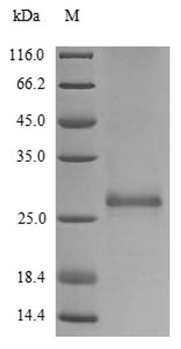 (Tris-Glycine gel) Discontinuous SDS-PAGE (reduced) with 5% enrichment gel and 15% separation gel.
