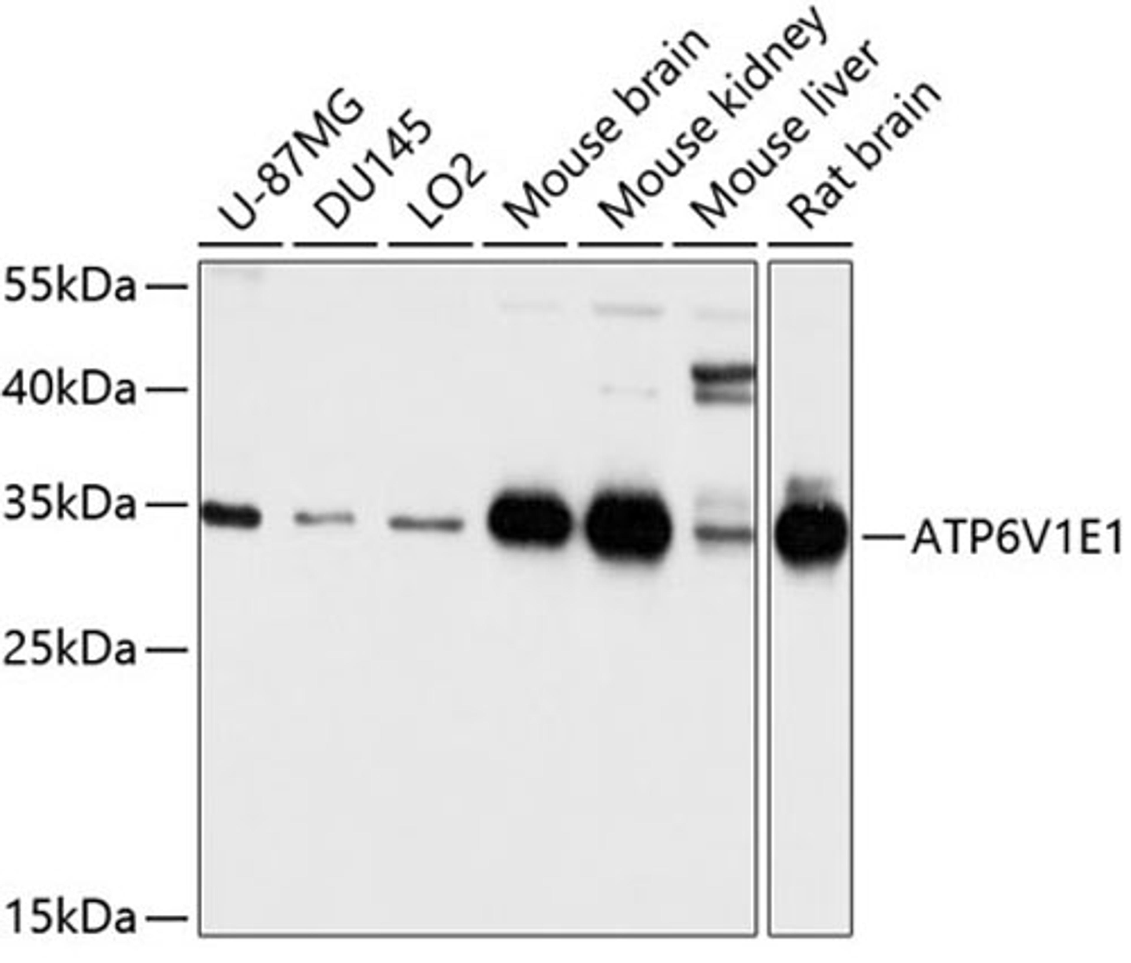 Western blot - ATP6V1E1 antibody (A3756)