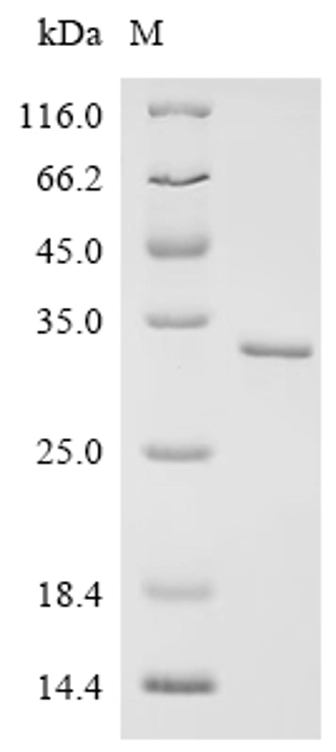 (Tris-Glycine gel) Discontinuous SDS-PAGE (reduced) with 5% enrichment gel and 15% separation gel.