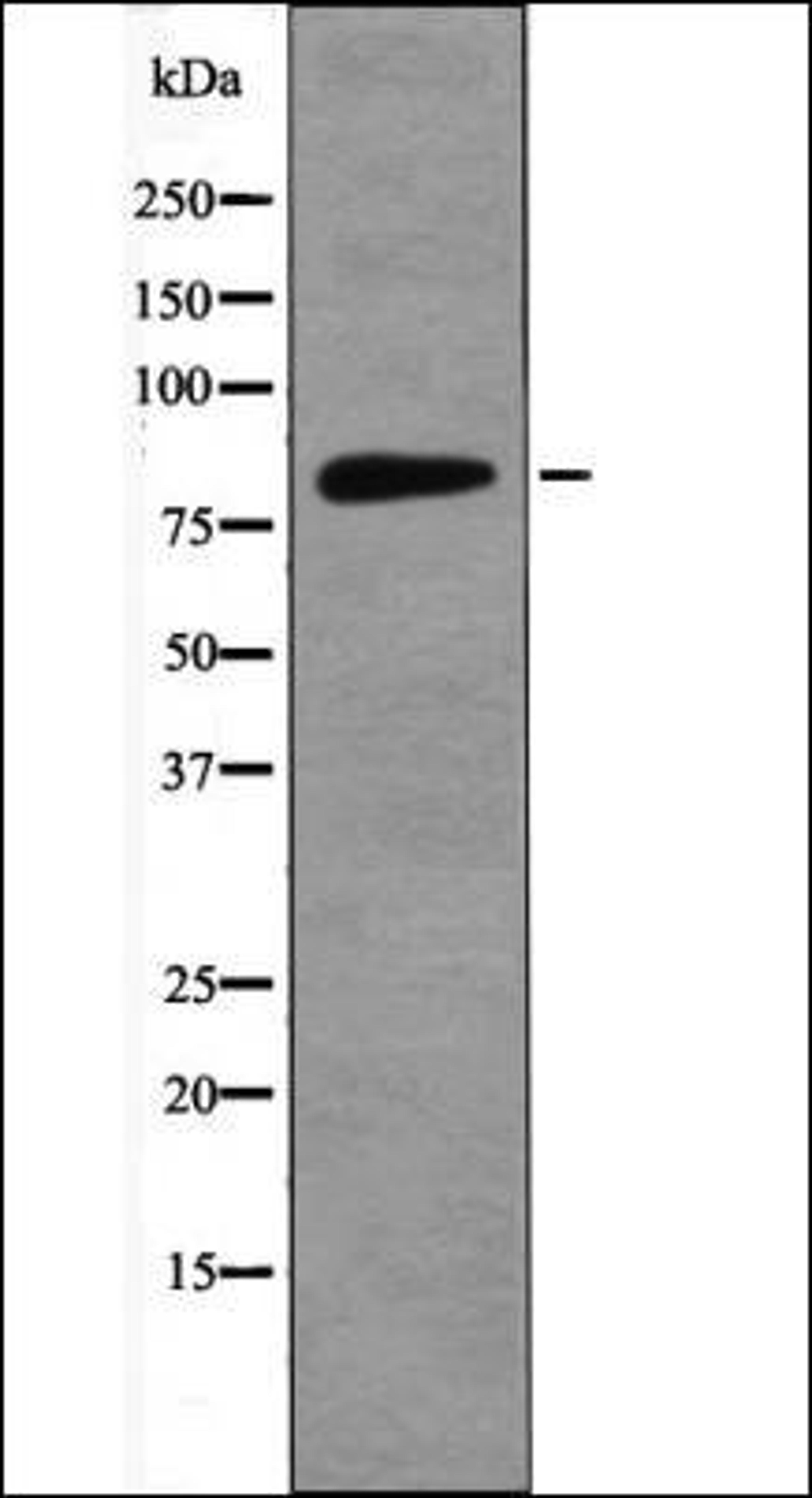 Western blot analysis of HeLa whole cell lysates using RSK3 -Phospho-Thr356- antibody