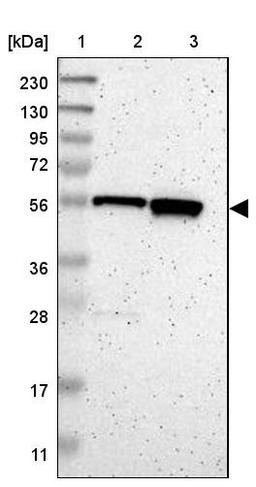 Western Blot: C17orf80 Antibody [NBP1-83637] - Lane 1: Marker [kDa] 230, 130, 95, 72, 56, 36, 28, 17, 11<br/>Lane 2: Human cell line RT-4<br/>Lane 3: Human cell line U-251MG sp