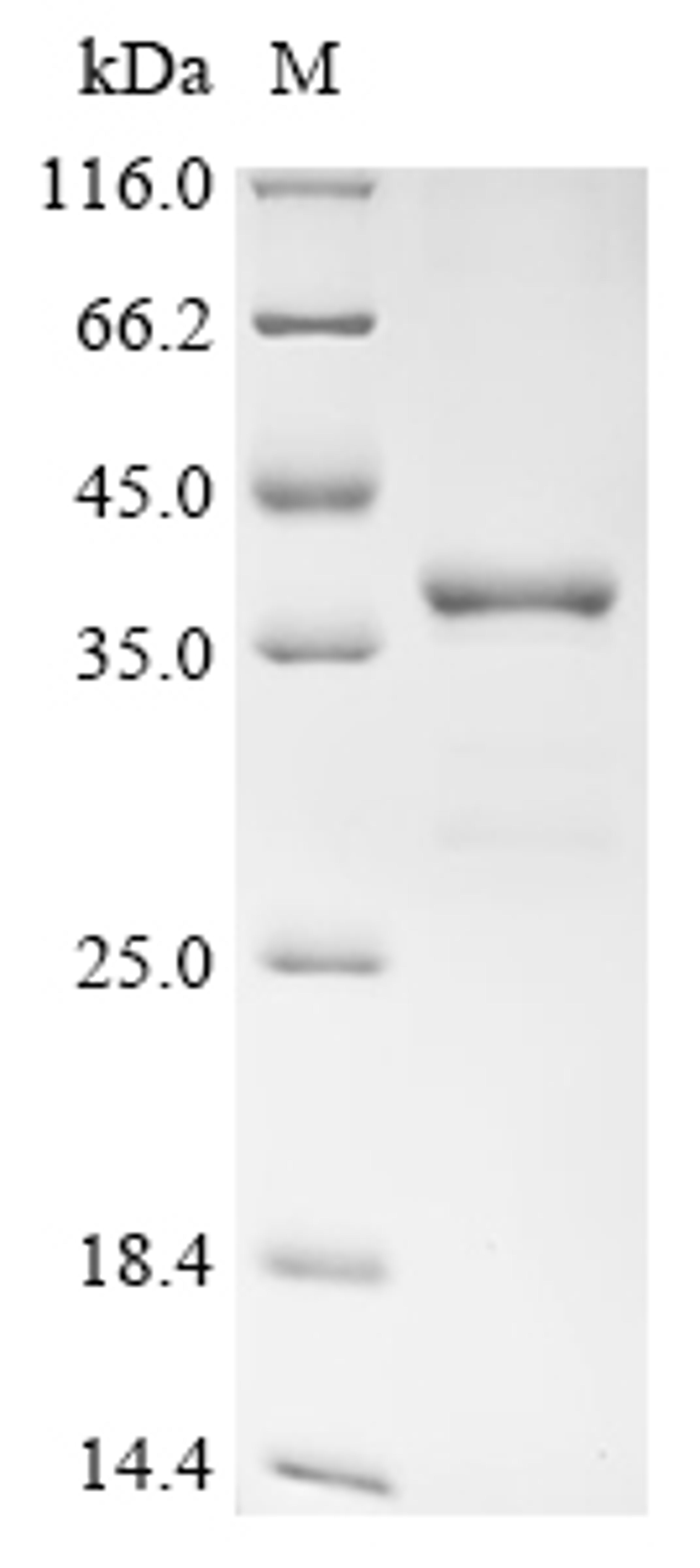 (Tris-Glycine gel) Discontinuous SDS-PAGE (reduced) with 5% enrichment gel and 15% separation gel.