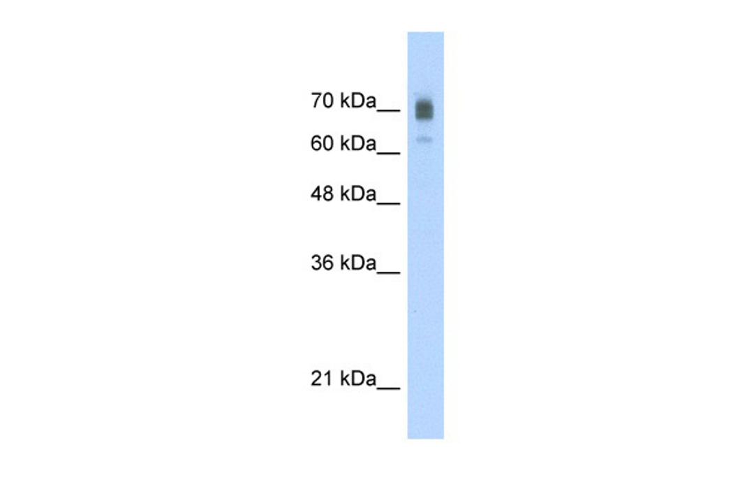 Antibody used in WB on Human Jurkat cells at 2.5 ug/ml.