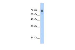 Antibody used in WB on Human Jurkat cells at 2.5 ug/ml.