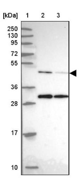 Western Blot: ACTR3 Antibody [NBP2-33623] - Lane 1: Marker [kDa] 250, 130, 95, 72, 55, 36, 28, 17, 10<br/>Lane 2: Human cell line RT-4<br/>Lane 3: Human cell line U-251MG sp