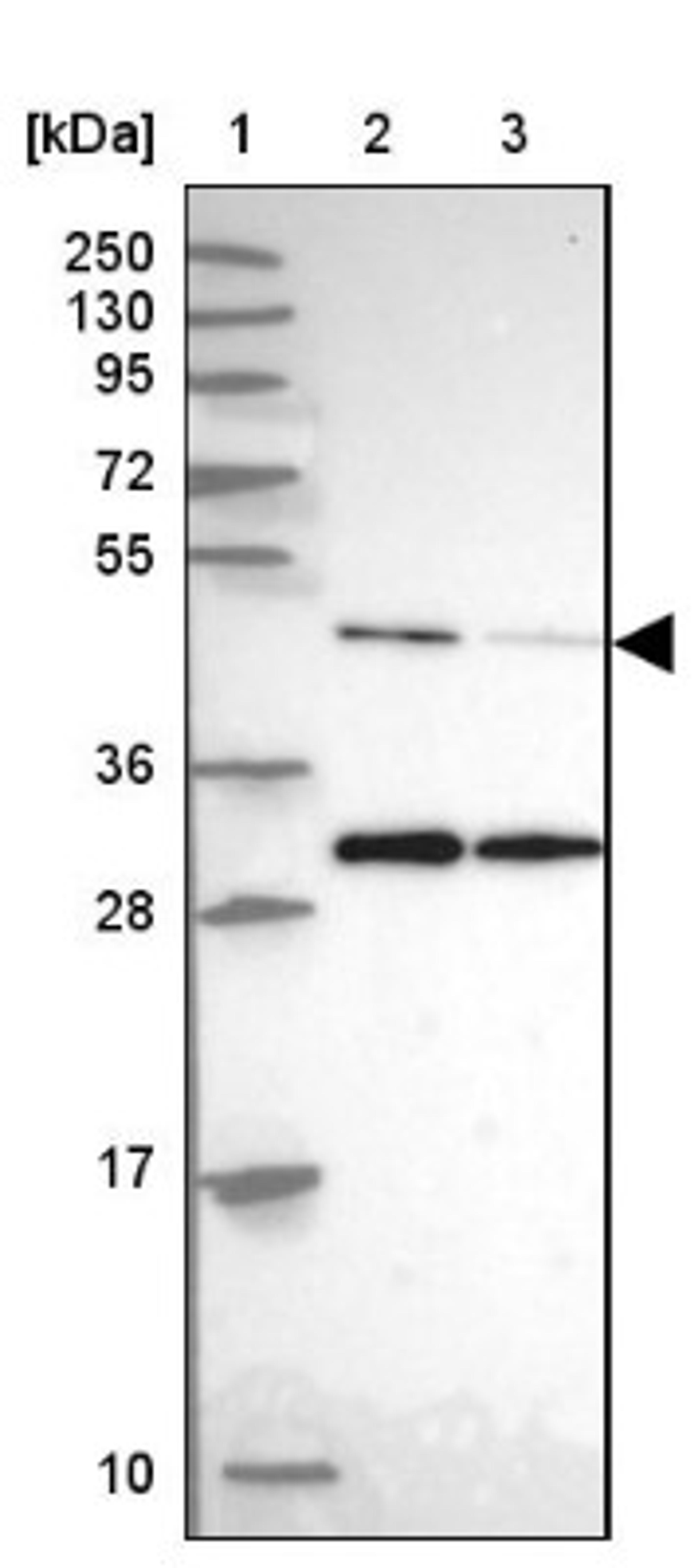 Western Blot: ACTR3 Antibody [NBP2-33623] - Lane 1: Marker [kDa] 250, 130, 95, 72, 55, 36, 28, 17, 10<br/>Lane 2: Human cell line RT-4<br/>Lane 3: Human cell line U-251MG sp