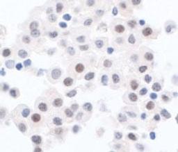 Detection of human PPP1CA by immunohistochemistry.