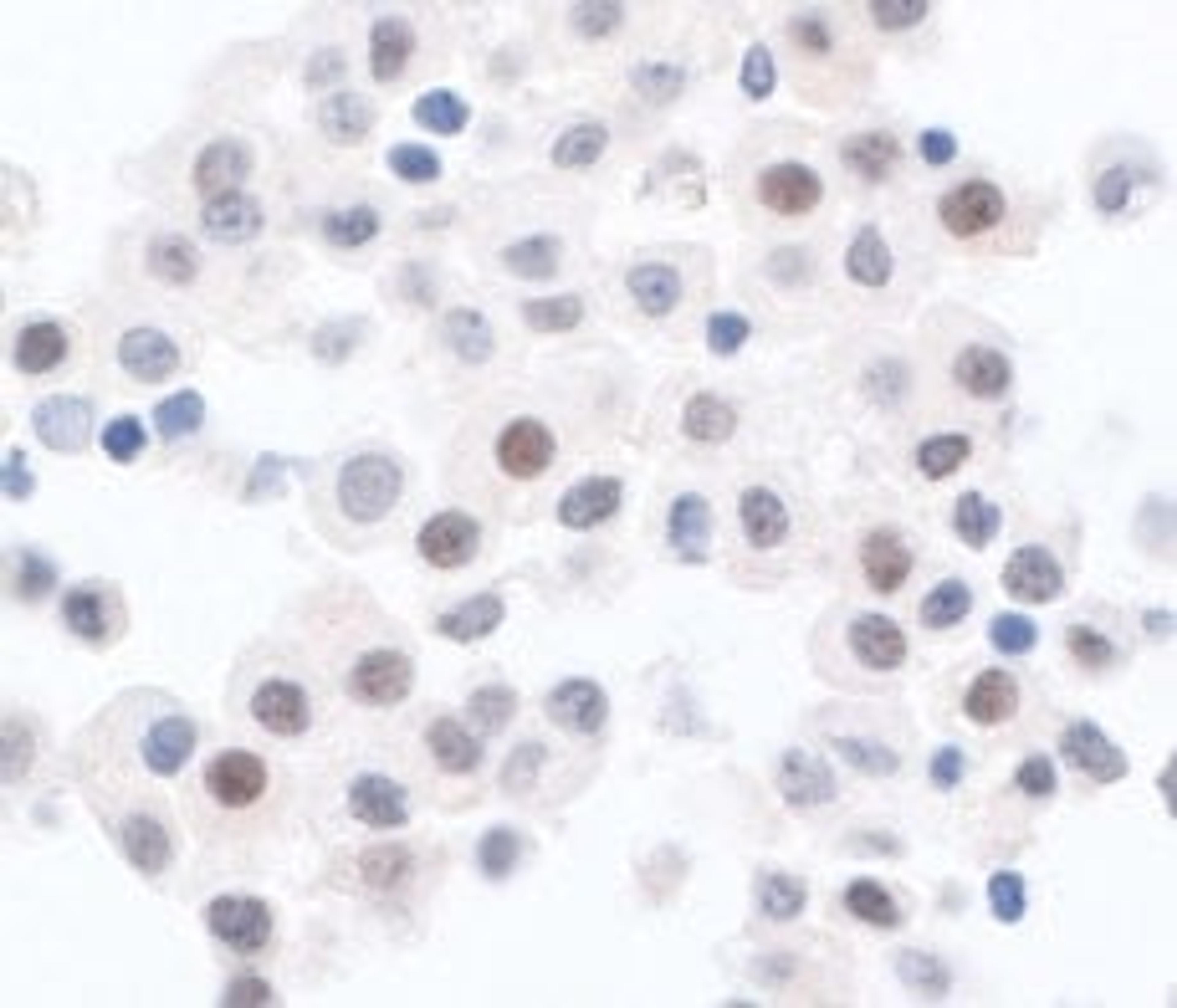 Detection of human PPP1CA by immunohistochemistry.