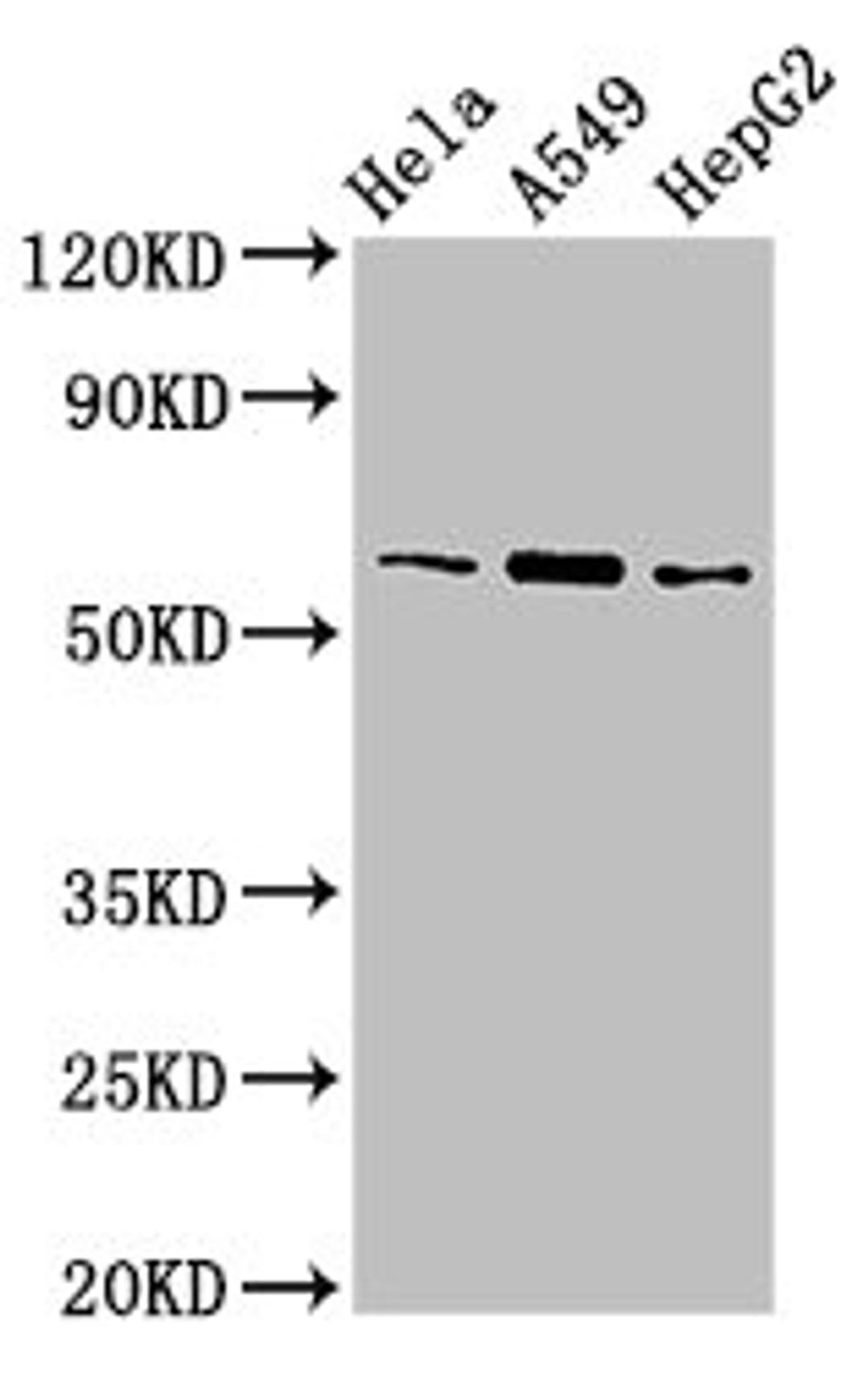 Western Blot. Positive WB detected in: Hela whole cell lysate, A549 whole cell lysate, HepG2 whole cell lysate. All lanes: TBL1X antibody at 3µg/ml. Secondary. Goat polyclonal to rabbit IgG at 1/50000 dilution. Predicted band size: 63, 58 kDa. Observed band size: 63 kDa
