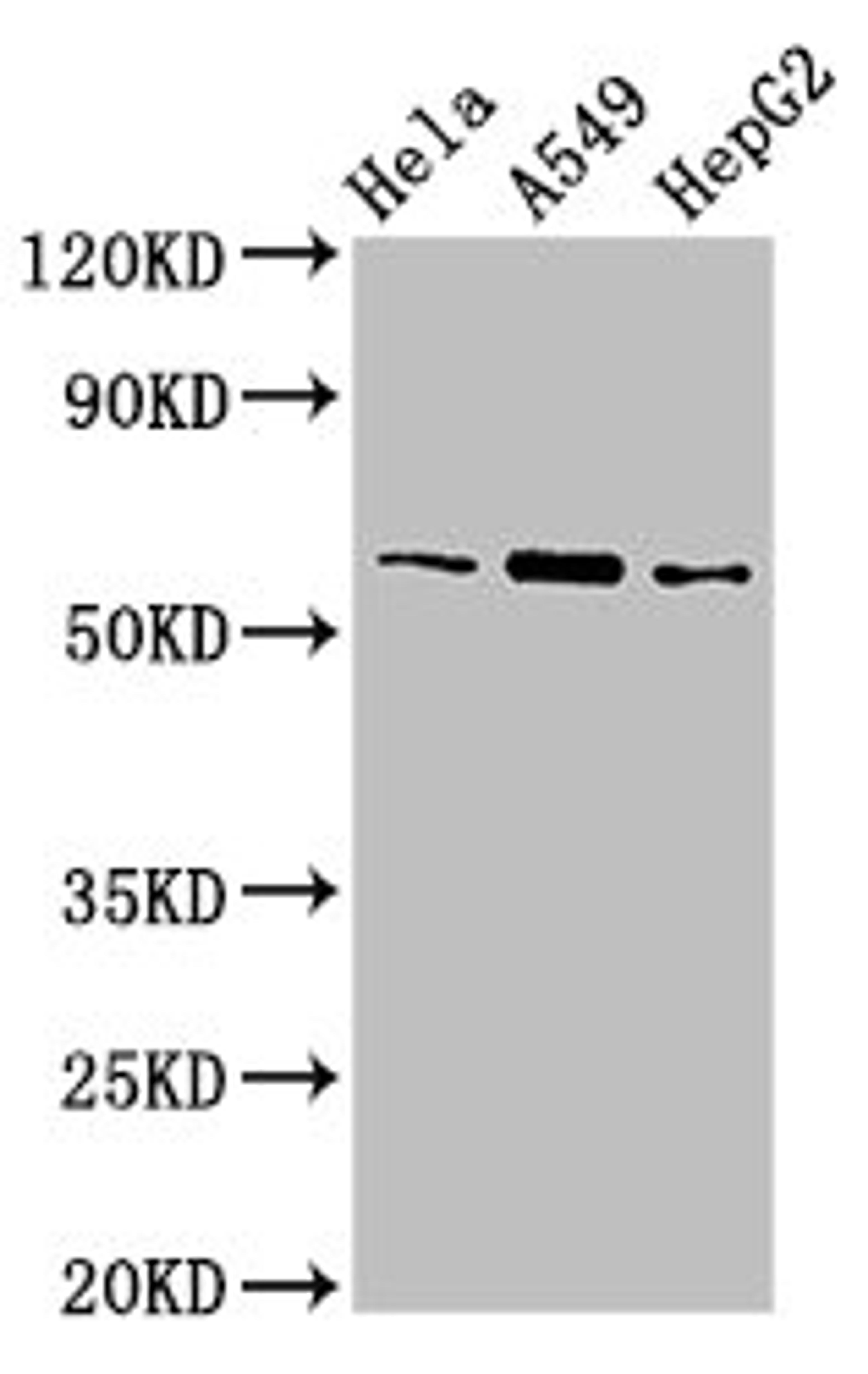 Western Blot. Positive WB detected in: Hela whole cell lysate, A549 whole cell lysate, HepG2 whole cell lysate. All lanes: TBL1X antibody at 3µg/ml. Secondary. Goat polyclonal to rabbit IgG at 1/50000 dilution. Predicted band size: 63, 58 kDa. Observed band size: 63 kDa